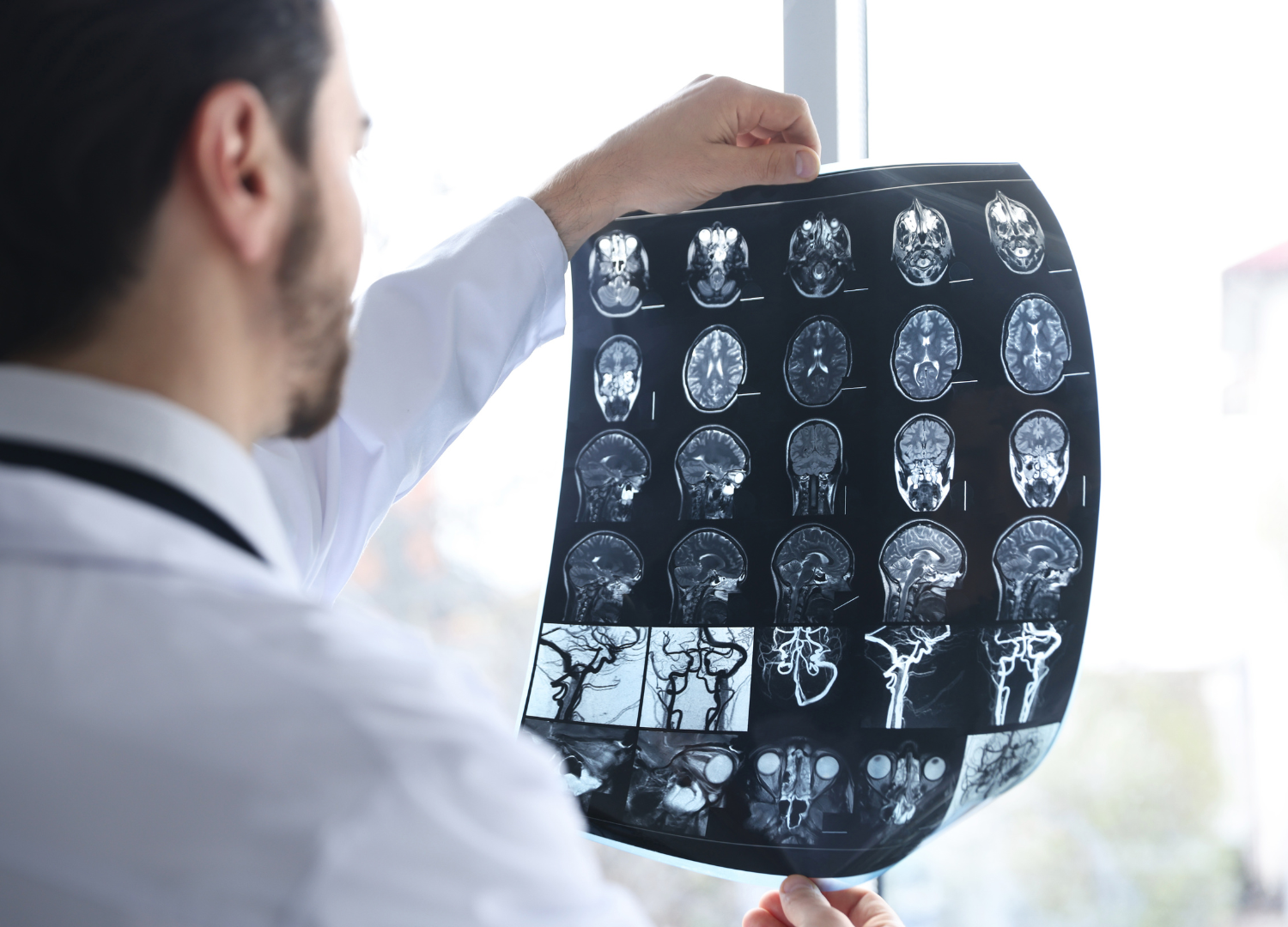 Inchaço no cérebro causado por tumor: o que a proteína Aquaporina 4 tem a ver com isso?